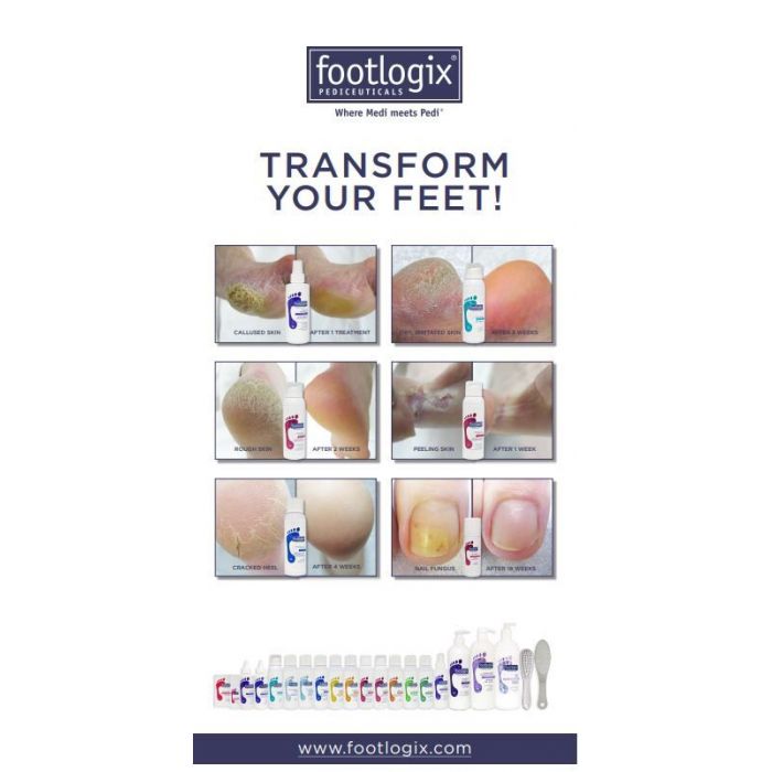 Footlogix Roll-Up Banner Before&After 79x200cm main product photo