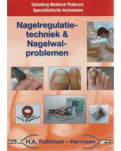 Nagelregulatietechniek & nagelwalproblemen