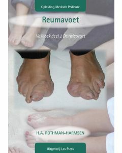 Reumavoet