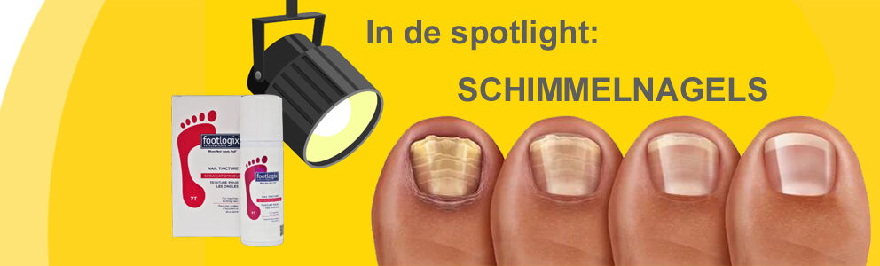 schimmelnagels